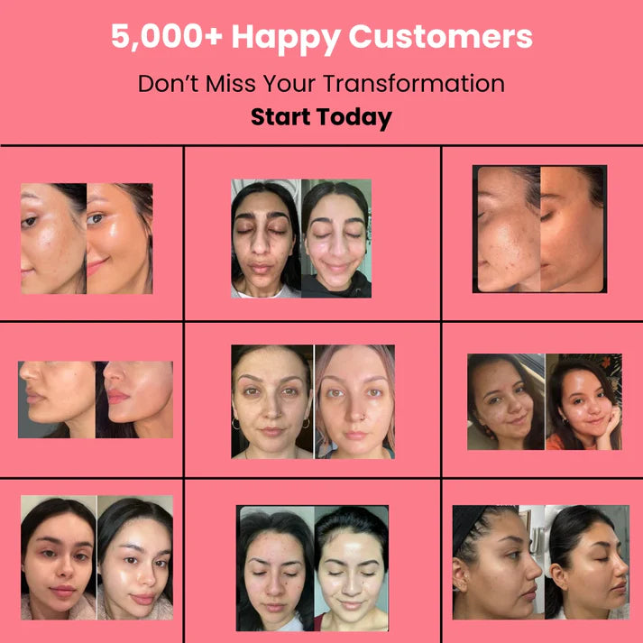 HOYGI™ Collagen Peel off Mask