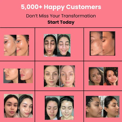 HOYGI™ Collagen Peel off Mask