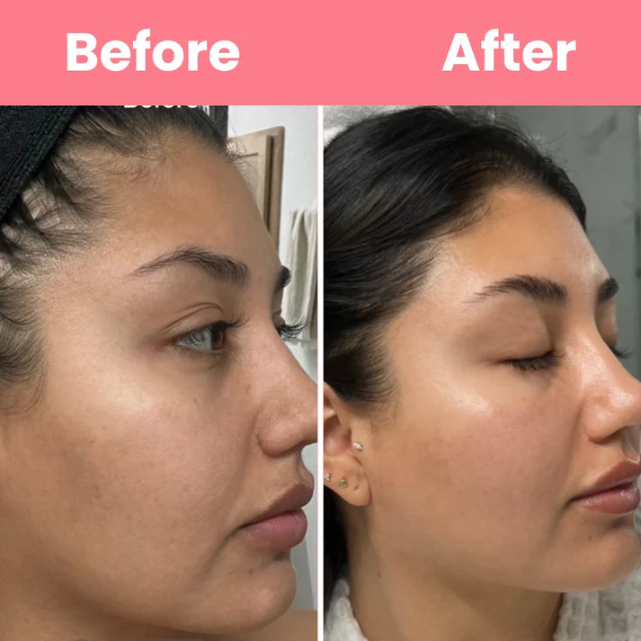 HOYGI™ Collagen Peel off Mask