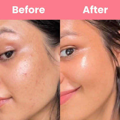 HOYGI™ Collagen Peel off Mask