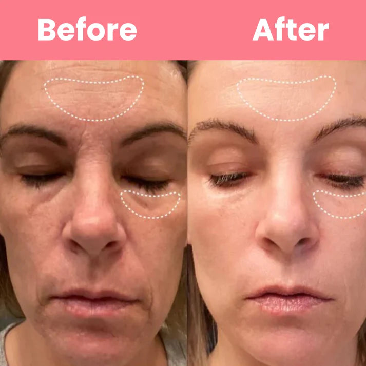 HOYGI™ Collagen Peel off Mask