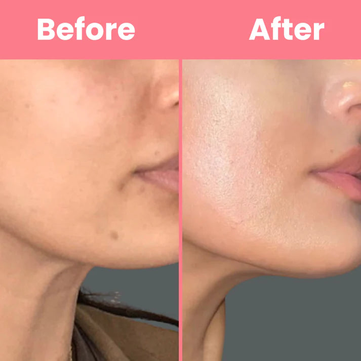 HOYGI™ Collagen Peel off Mask